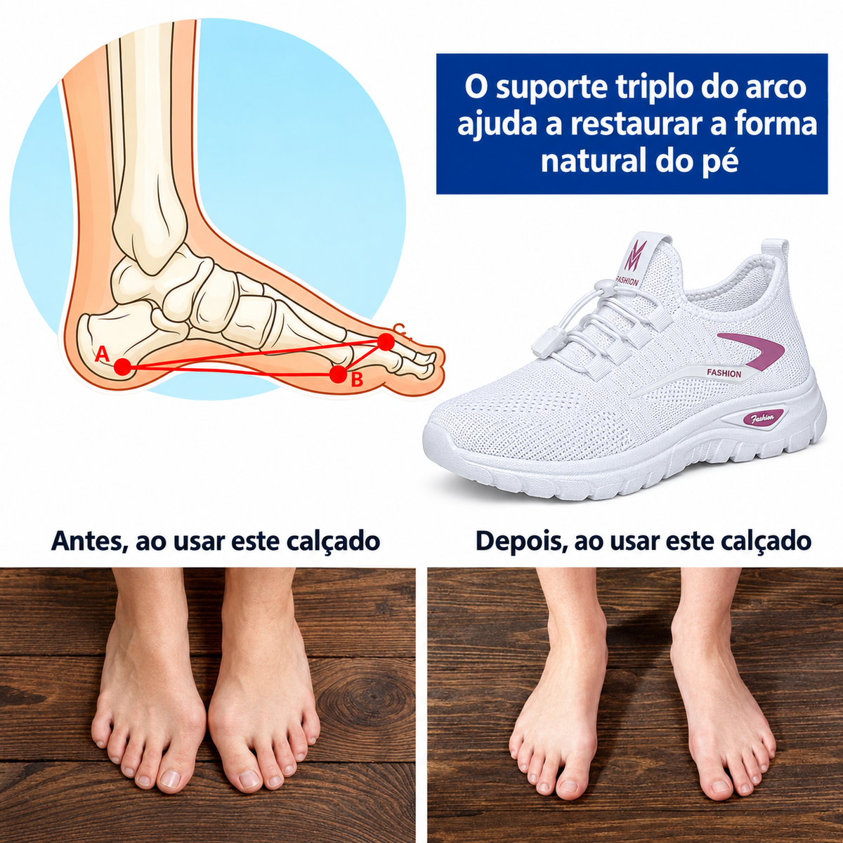 ⏰ Último dia! 30% de desconto! Não perca! Sapatos ortopédicos com design ergonómico e absorção de impacto ✅ Suporte para o arco do pé, concebidos especificamente para as mulheres europeias.